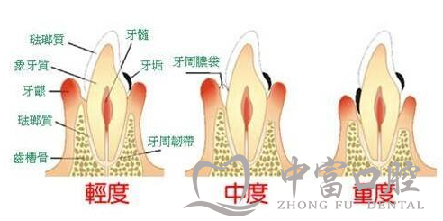 哪些情况不适合做牙齿矫正?