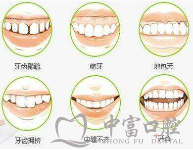 儿童替牙期牙齿不齐是什么回事?