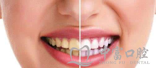 常见的口腔疾病以及预防