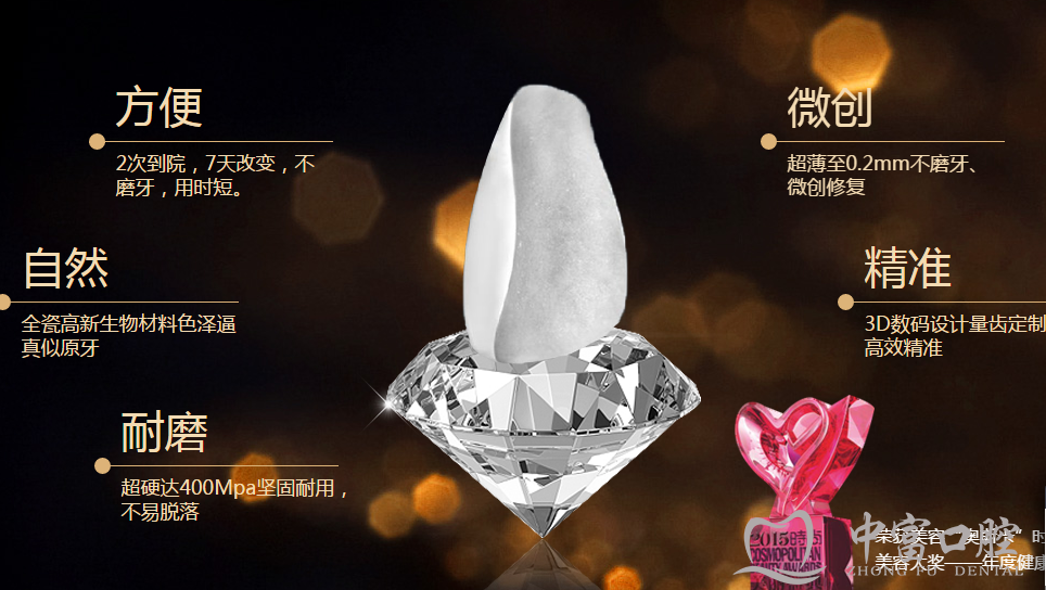 牙齿贴面修复的常识和优缺点 