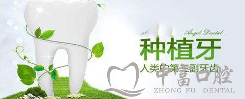 种植牙哪家医院好