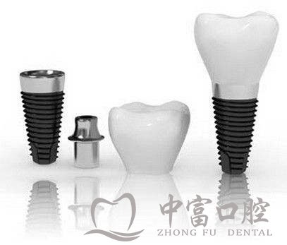 种植牙究竟为什么那么贵