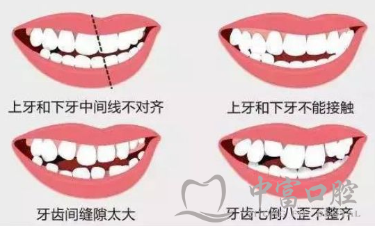 牙齿不齐的原因及危害。