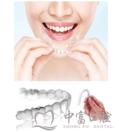 为什么要做牙齿矫正？