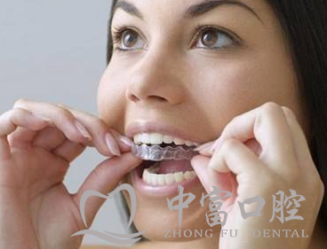 关于牙齿保持器，你想了解的都在这里!